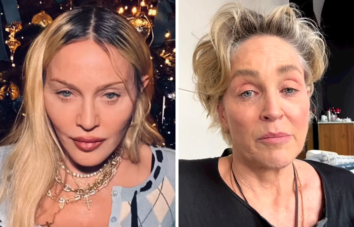 Madonna and Sharon Stone, side-by-side, showcasing the impact of plastic surgery.