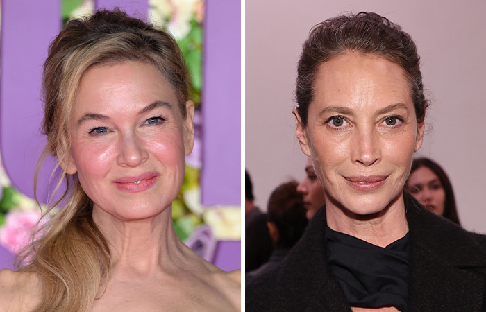 Side-by-side photos of Renée Zellweger and Christy Turlington showing the impact of plastic surgery on same-age celebrities at an event.