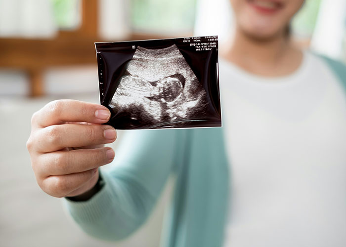 41 People Share What Baby Name Immediately Makes Them Lose All Respect For The Parents