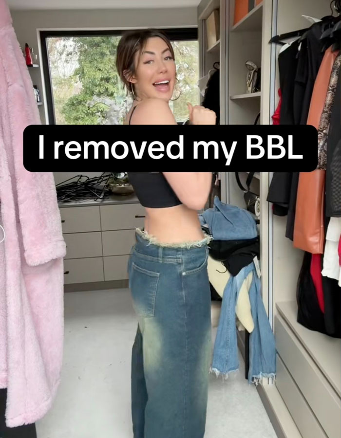 Woman showing new figure after BBL removal, smiling in a closet with jeans and a black top.