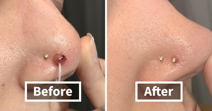 These 24 Before/Afters Are Making Us Poor And We’re Not Mad