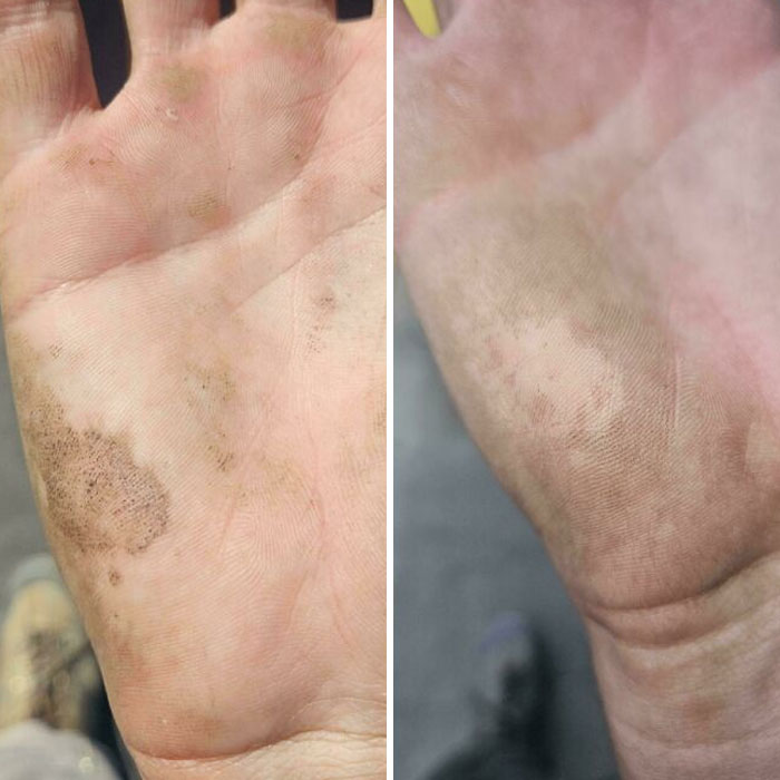 Close-up of two hands with mildly interesting dirt patterns, showing unique palm textures and small dark spots.