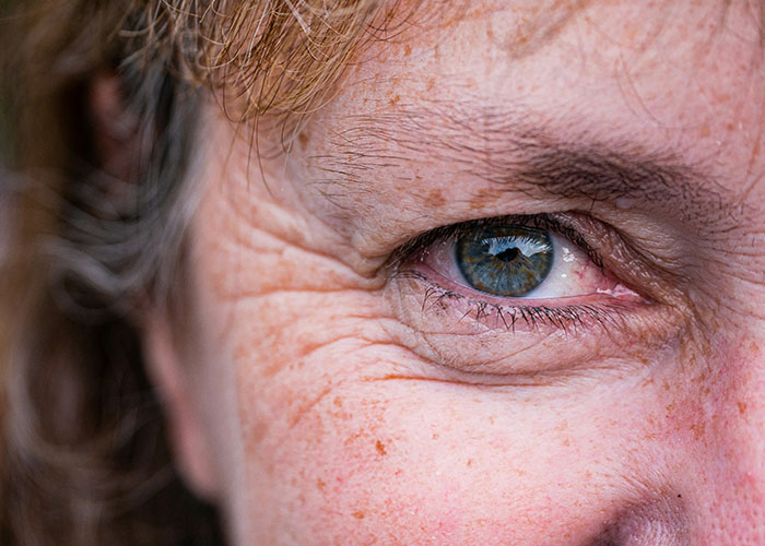 Primer plano de un ojo con arrugas y pecas, mostrando rasgos poco atractivos que resultan atractivos para algunas personas.