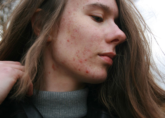 30 Features That Most Find Unattractive But For Folks In This Online Thread, It’s The Opposite