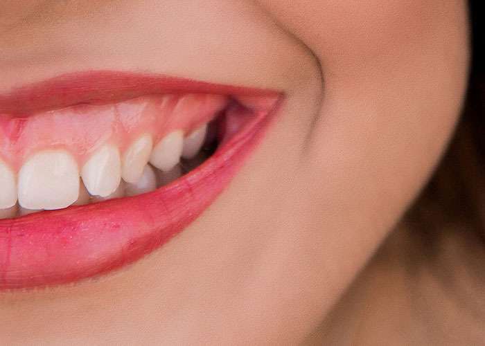 Close-up of a smiling mouth with lipstick, highlighting the beauty of natural, unique features.