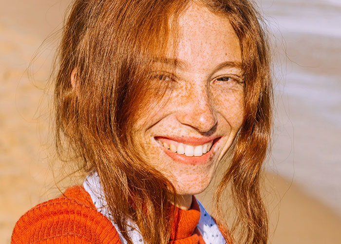 Smiling woman with freckles, red hair enjoying a sunny day at the beach, symbolizing unique features being appreciated.
