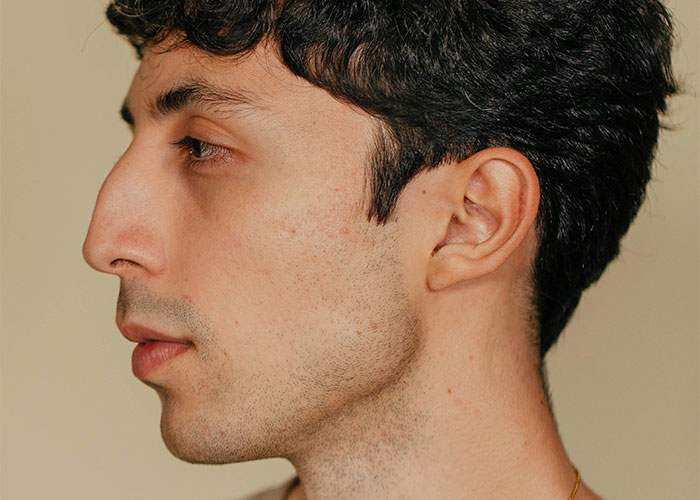 Joven con rasgos poco atractivos vistos desde perfil, mostrando confianza y atractivo único en su expresión facial.