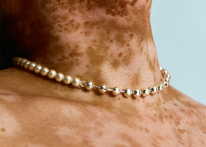 Collar de perlas en cuello con manchas oscuras, mostrando rasgos poco atractivos que algunas personas consideran belleza única.