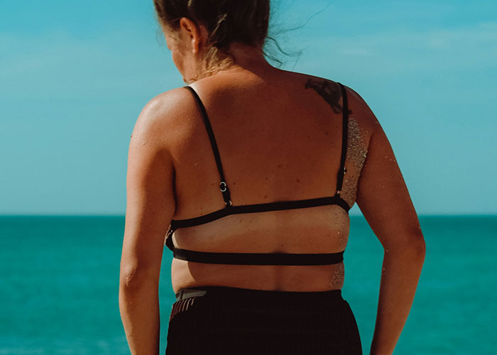 Mujer con rasgos poco comunes disfrutando del sol en la playa, mostrando belleza en rasgos poco atractivos.
