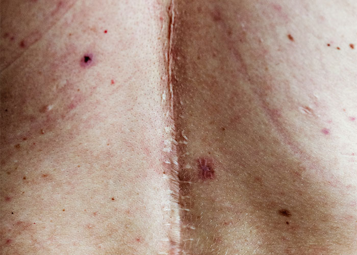 Close-up of skin texture with natural scars and blemishes, highlighting unique features people find attractive.