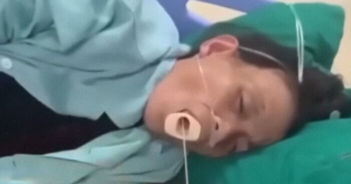 Disturbing Video Of Tapeworm Being Extracted From Woman’s Mouth Is Going Viral