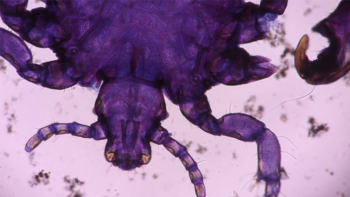 Close-up of a purple insect under a microscope, related to darkest stories found online.