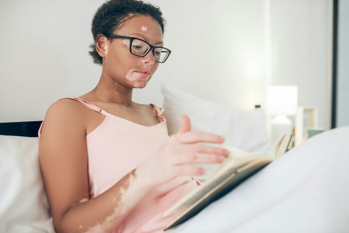 Person with vitiligo wearing glasses and a pink top, reading a book in bed, appreciating unconventional beauty.