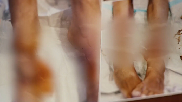 Blurred image of Ruby's child's feet from the abuse. Blurred image of Ruby's child's feet from the abuse.