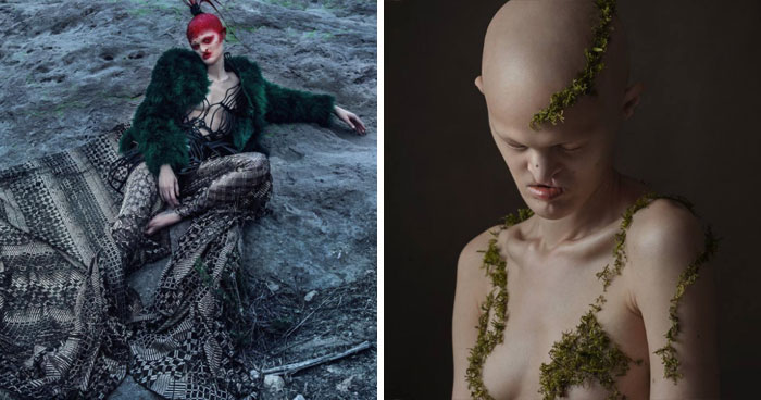 Meet Melanie Gaydos, A Striking Model Who Has Made The Most Of Her Rare Genetic Disorder