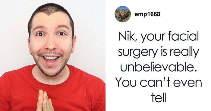 “Tuck It Under Your Pants And Hide It”: Nikocado Avocado Shows Sagging Skin After Losing 250 lbs