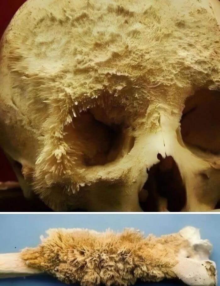 Cráneo y hueso cubiertos de un extraño crecimiento que resulta ser aterrador.