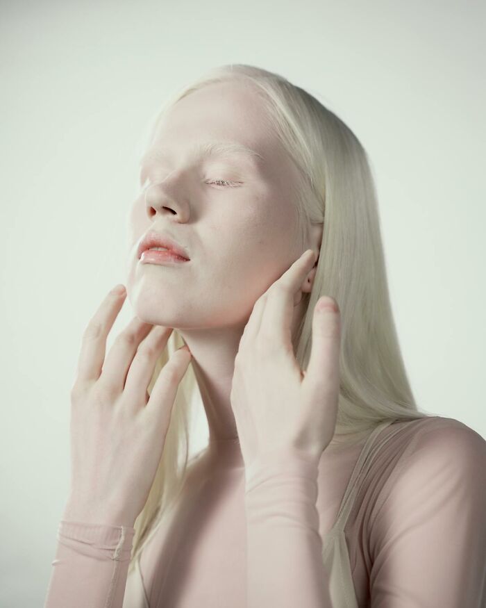 "Hip Dips!": 30 Conventionally Unattractive Features That These People Find Beautiful