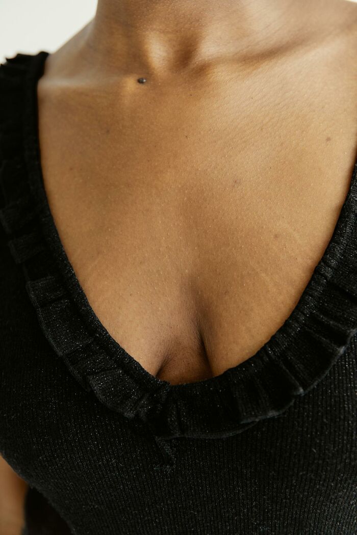Close-up of a person's neck and chest wearing a black ruffled top, showcasing beauty in unconventional features.