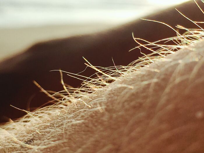 Close-up view of arm hair, illustrating people's genetic differences and variations in hair growth under sunlight.