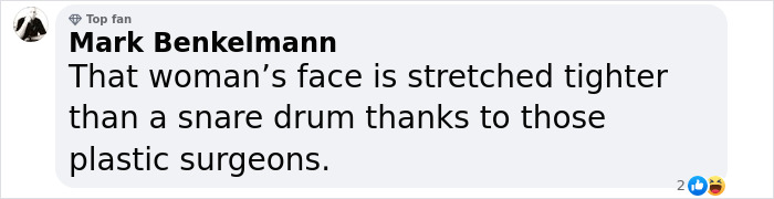 Comment on photo with text about a woman's appearance, referencing plastic surgeons.