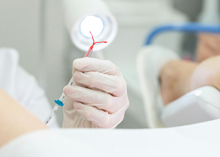 Medical professional holding an IUD, emphasizing proactive health measures for women.