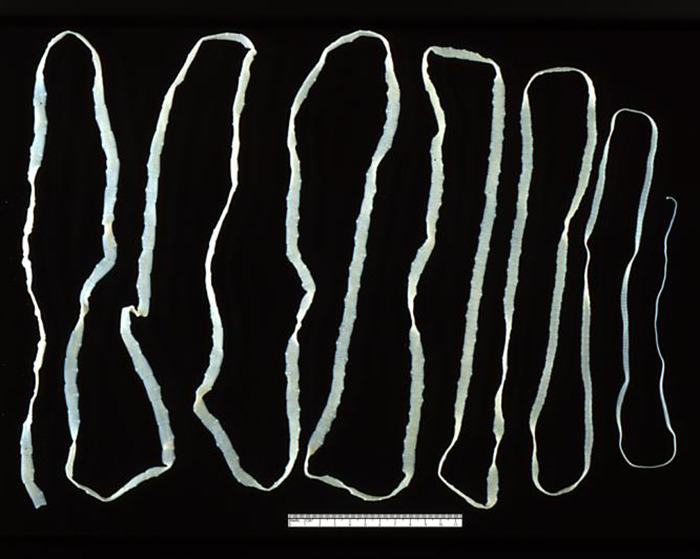 Tapeworm extracted from a woman's body displayed on a black background.