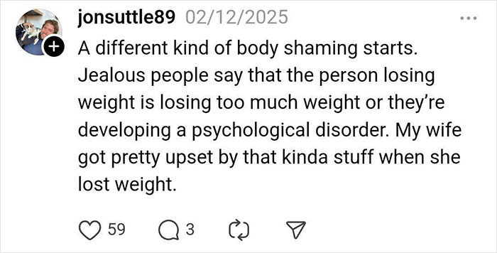 Instagram post discussing body shaming and criticisms following weight loss, related to hair loss experiences.