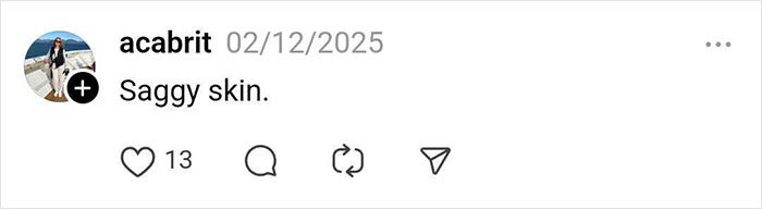 Instagram comment about saggy skin, relevant to hair loss and weight loss effects.