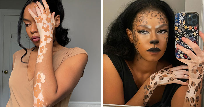 Dancer-Turned-Artist Amara Aleman Turns Her Vitiligo Into Vibrant Body Art (20 Pics)