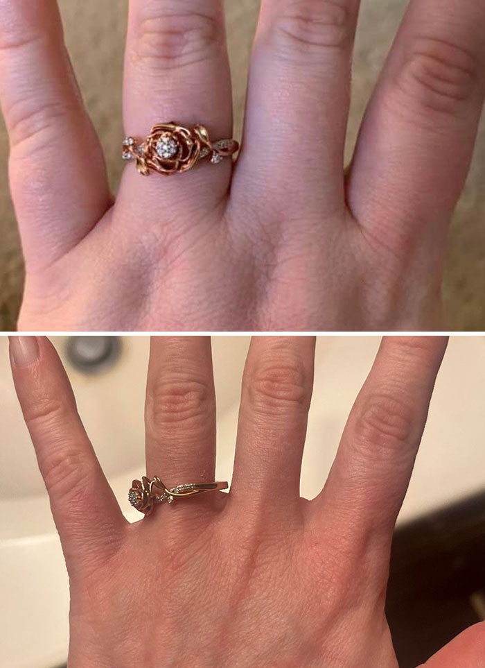 Close-up of hands with a rose-shaped ring, highlighting transformation in finger size, related to weight-loss.