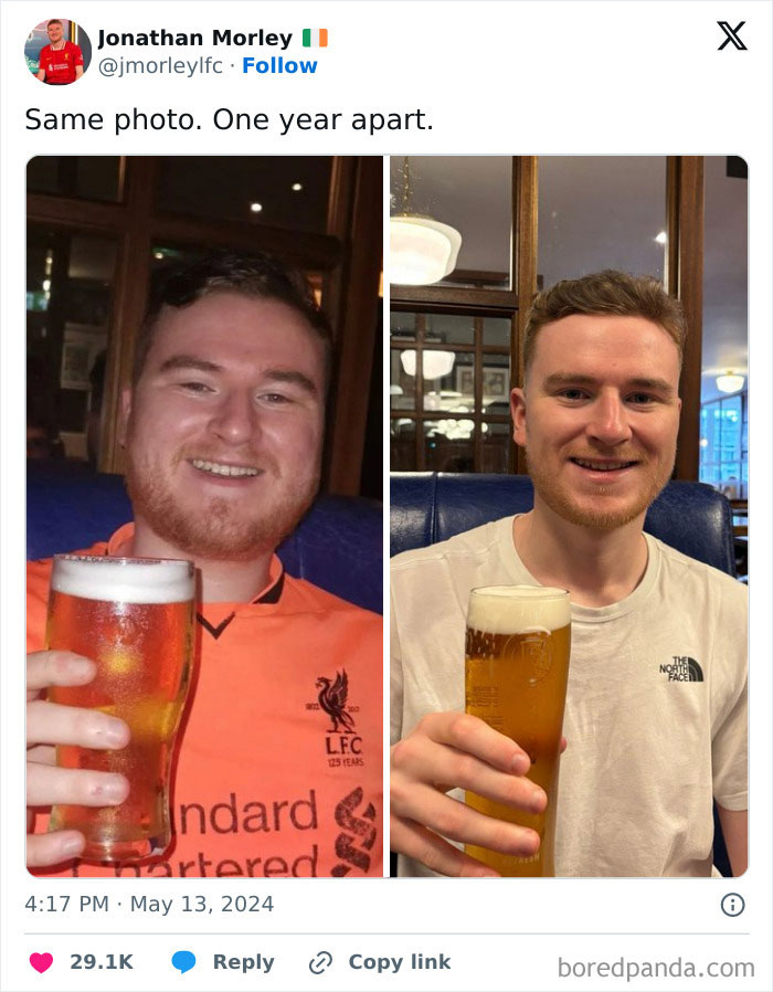 Man showing weight-loss transformation over one year, holding a beer in each before and after photo.