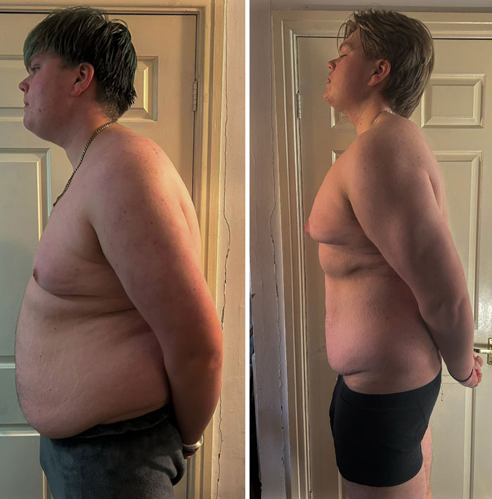 Side-by-side weight-loss transformation showing significant change.