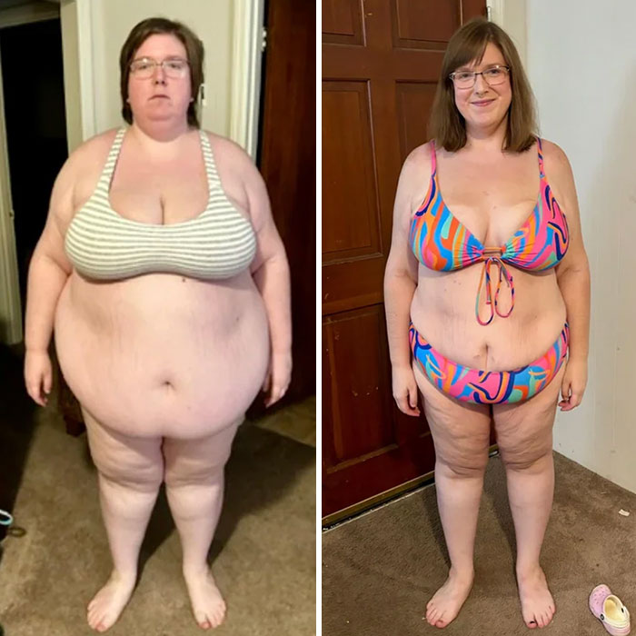 Weight-loss transformation showing a woman's before and after progress in striped and colorful bikinis.