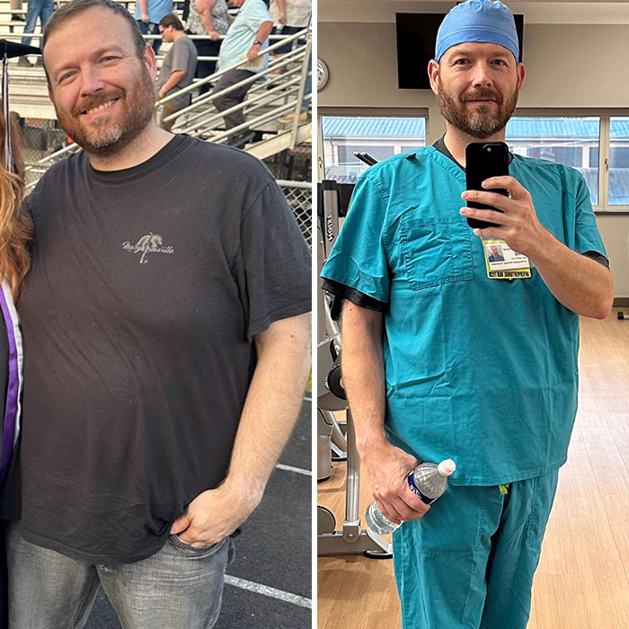 Man showing weight loss transformation, in casual wear before, and scrubs after, holding a water bottle in a gym setting.