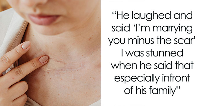 Woman Postpones Her Wedding, People Advise To Call It Off Because Of Fiancé’s Hurtful Comments