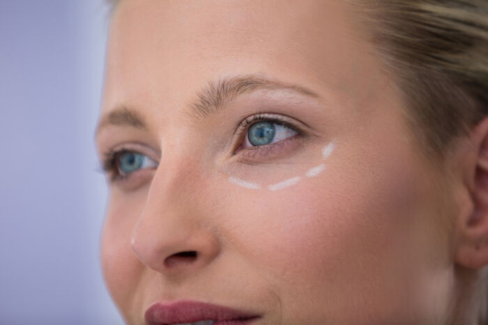 Close-up of a woman's face with markings below her eye, illustrating a rare cosmetic procedure.