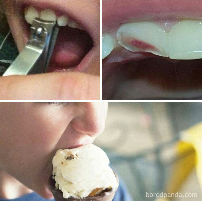 Collage de imágenes inquietantes: cortaúñas en dientes, diente dañado, persona mordiendo helado.