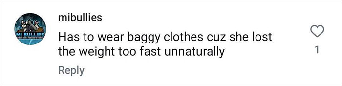 Comment on Ozempic transformation: "She has to wear baggy clothes due to fast, unnatural weight loss.