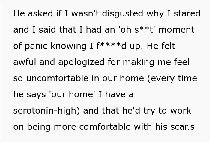 Text message about a boyfriend apologizing for discomfort over burn scars, expressing commitment to feeling at home.