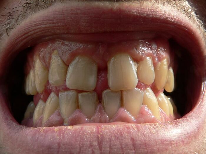 Close-up of a person's teeth, showing dental structure, related to dark side history facts.