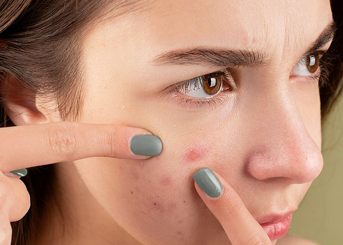 Woman examining skin, demonstrating beauty tips for skincare.