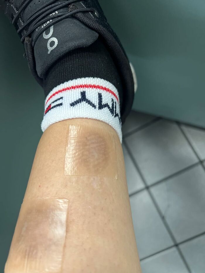 A leg with two band-aids, wearing a black shoe and sock, showcasing bargain life details.