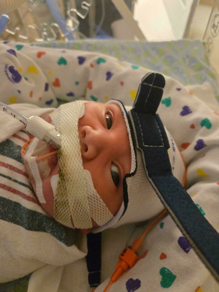 Newborn in hospital care with medical tubes, highlighting dads doing their best parenting moments and support.