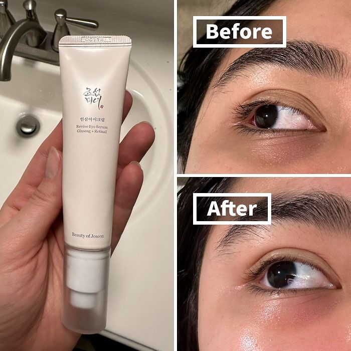 Eye serum effect shown in before and after images, highlighting its popularity in beauty products.