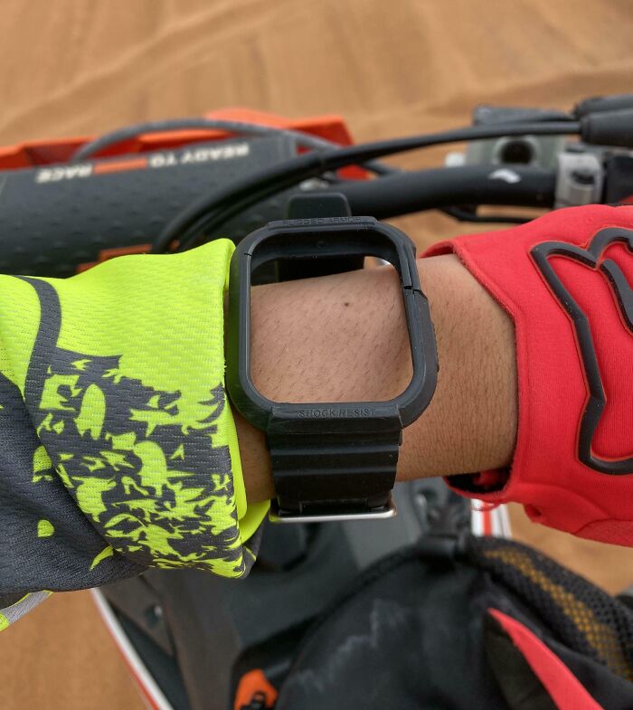 Broken watch on wrist after an expensive accident, wearing red and neon green gloves, on a bike.