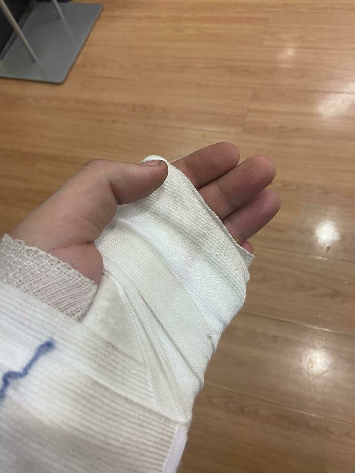 Injured hand in a cast on wooden floor, reflecting a worst day at work incident.