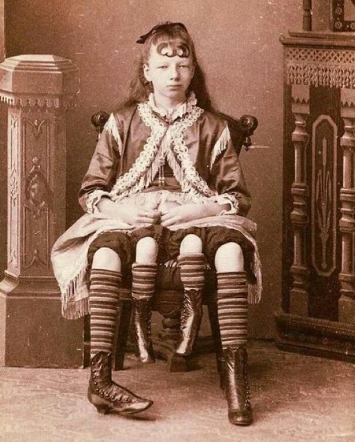 Victorian-era girl in unsettling photo, wearing striped stockings and a ruffled dress, sitting on a wooden chair.