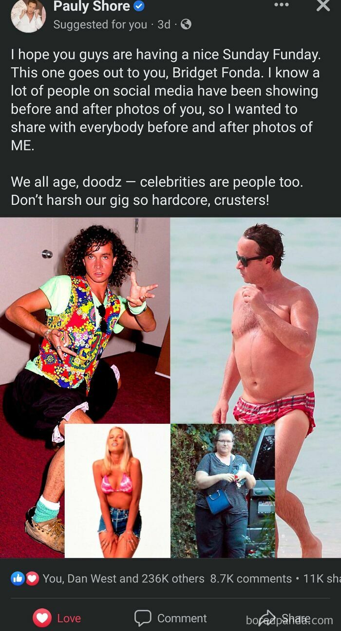 Pauly Shore shares before-and-after photos, supporting celebrities and aging, with a message about kindness online.