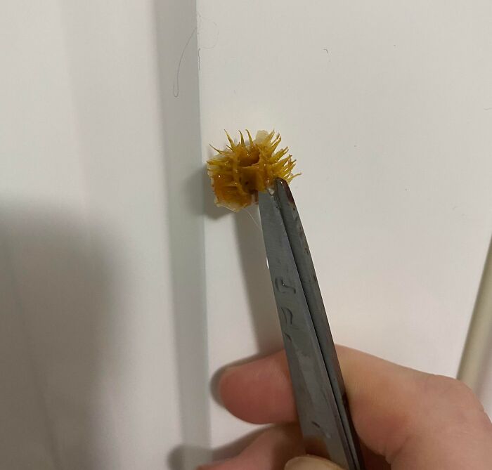 Tweezers holding a strange, spiky discovery in food, highlighting a disgusting dining experience.